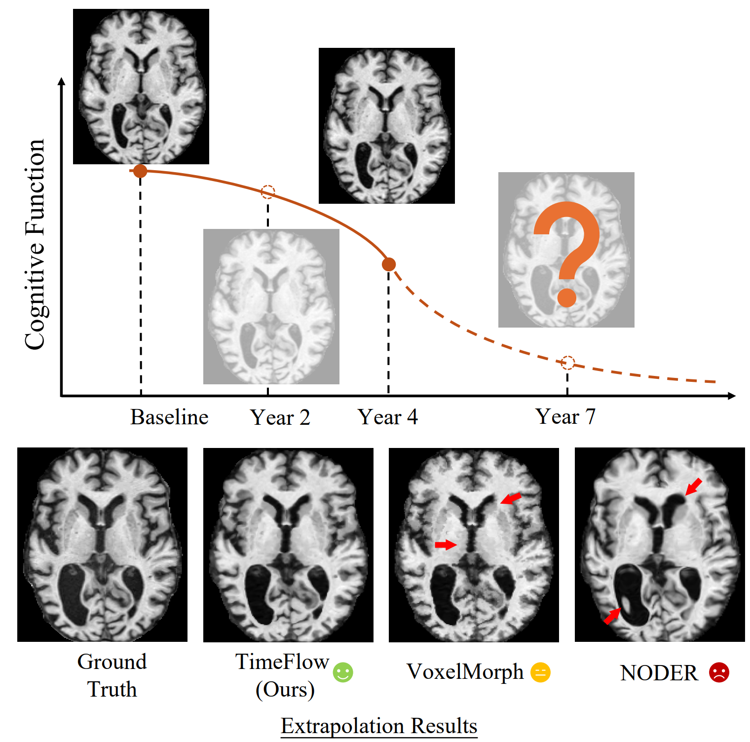 Longitudinal brain MRI registration overview